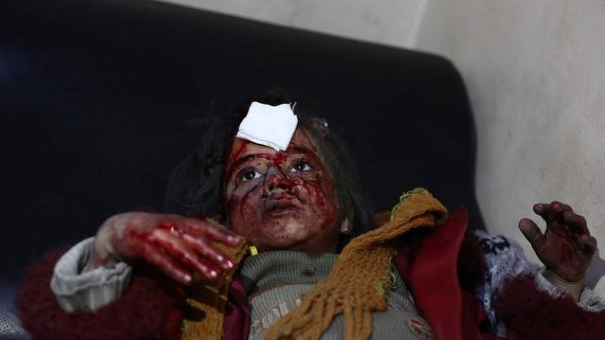 Una niña herida en los bombardeos de este jueves en Ghouta.-Foto: AFP / ABD DOUMANY