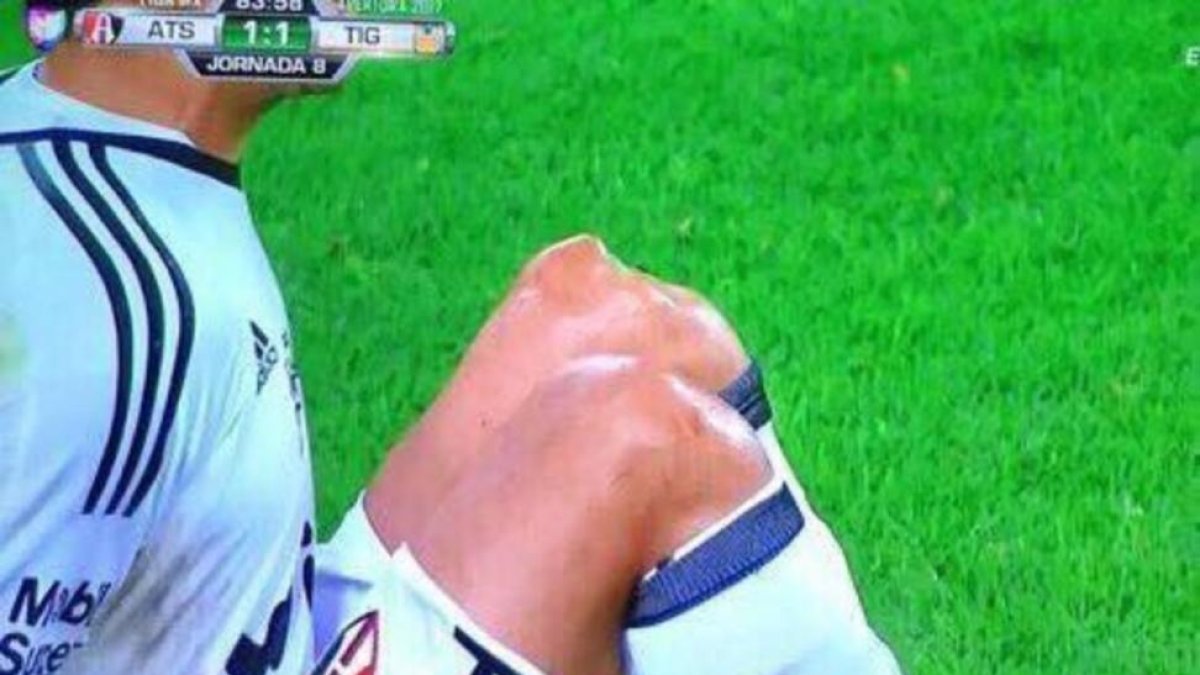 Óscar Ustari, tras lesionarse-TWITTER