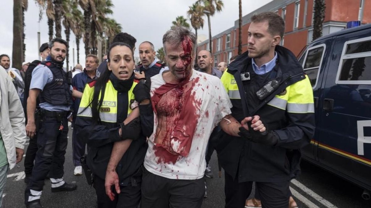 Uno de los heridos en la Escola Mediterrànea de la Barceloneta durante las cartas policiales el 1-O.-EL PERIÓDICO