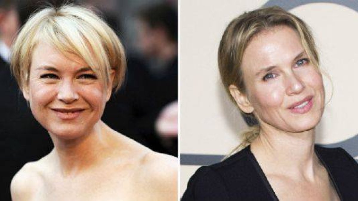 Reneé, en el 2001 y en la actualidad.-Foto: AP