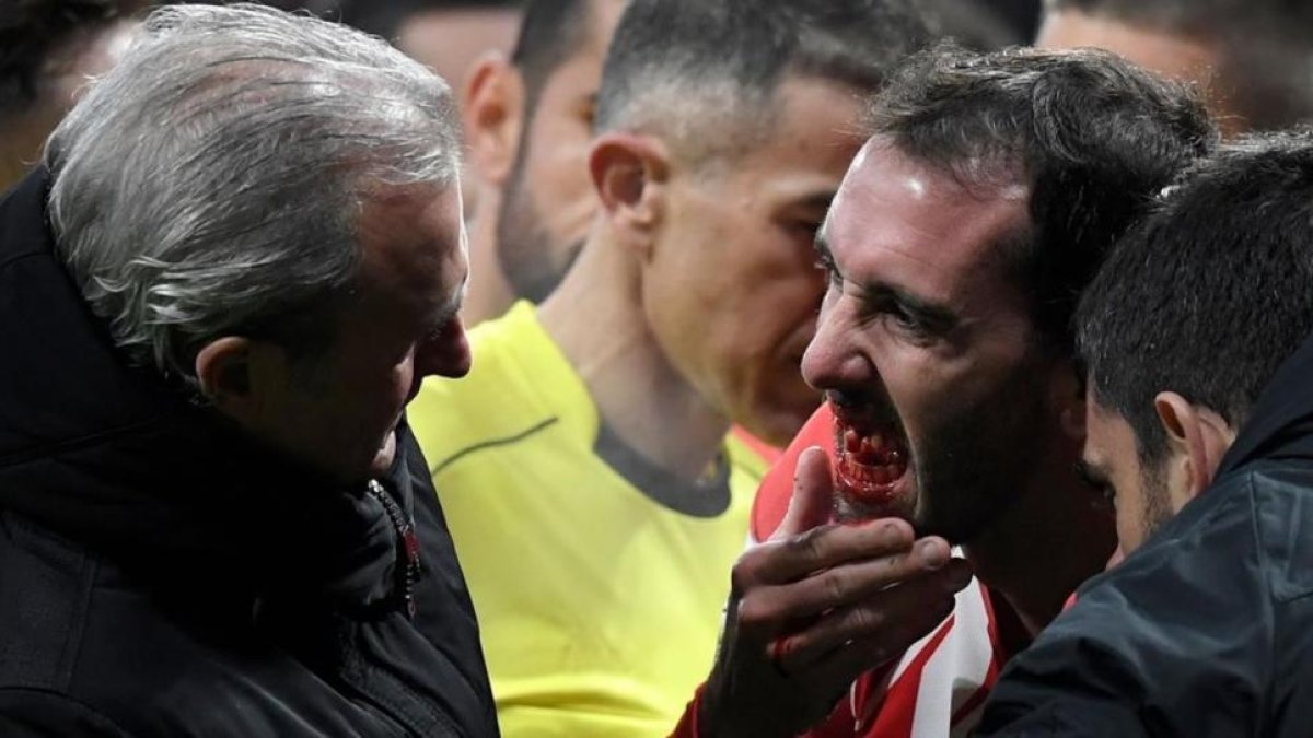 Godín le muestra al doctor del Atlético su boca donde le faltan los tres dientes que acaba de perder en un encontronazo con el meta valencianista Neto.-AFP