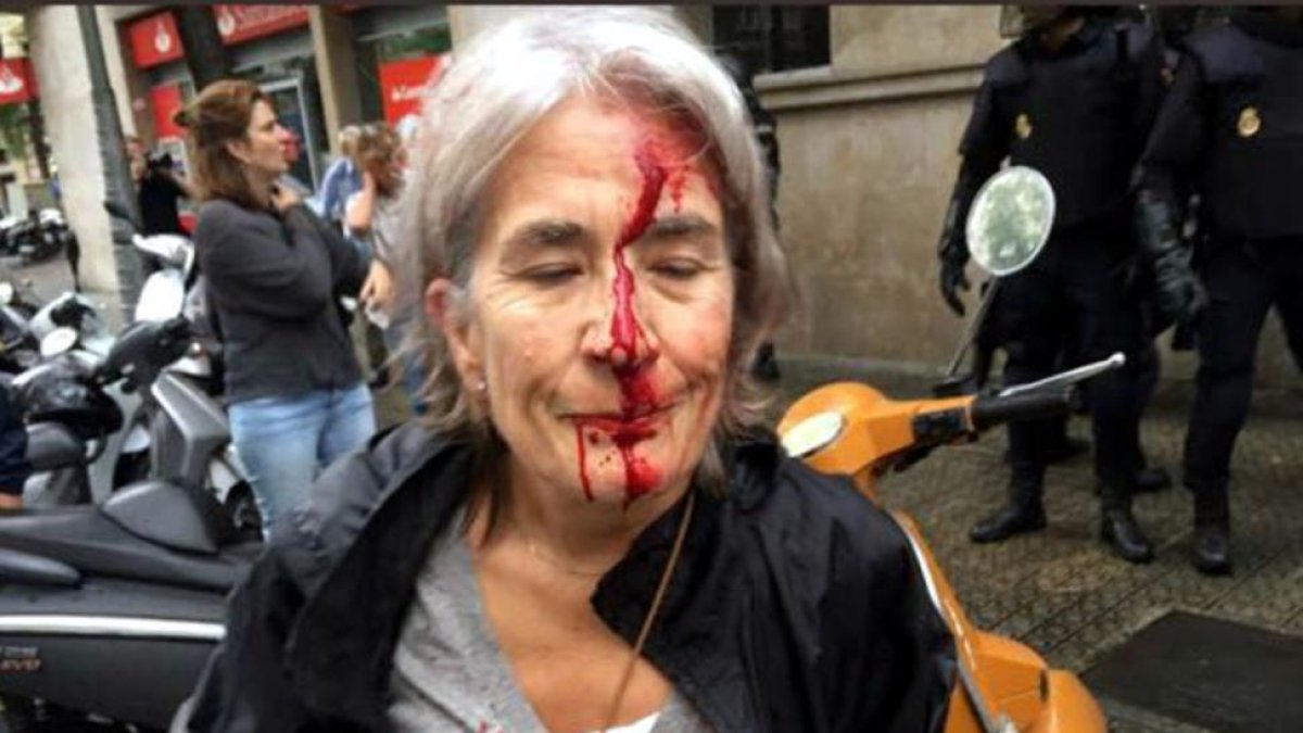 Una mujer con el rostro ensangrentado por las cargas policiales del 1-O-ACN