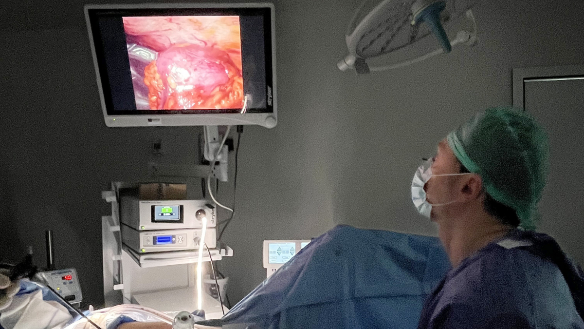 La intervención se realizó sin complicaciones y la paciente fue dada de alta a las 36 horas.