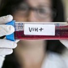 Una investigadora de la Facultad de Medicina del Hospital Germans Trias i Pujol, en Badalona, inspecciona una muestra con VIH-JOAN CORTADELLAS