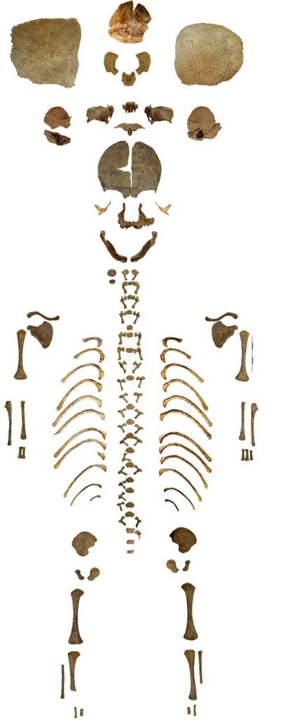 Restos del esqueleto del individuo recién nacido objeto del estudio.